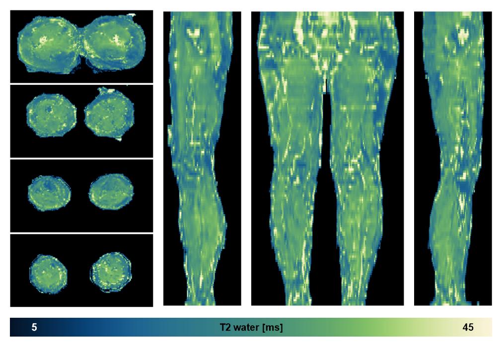 The water only T2 relaxation time of the lower extremity obtained from multi echo spin echo t2 mapping with EPG based reconstruction.